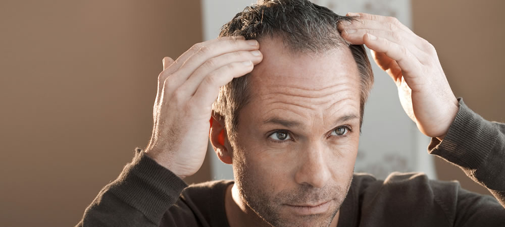 How To Tackle Men's Thinning Hair – Balkania Info